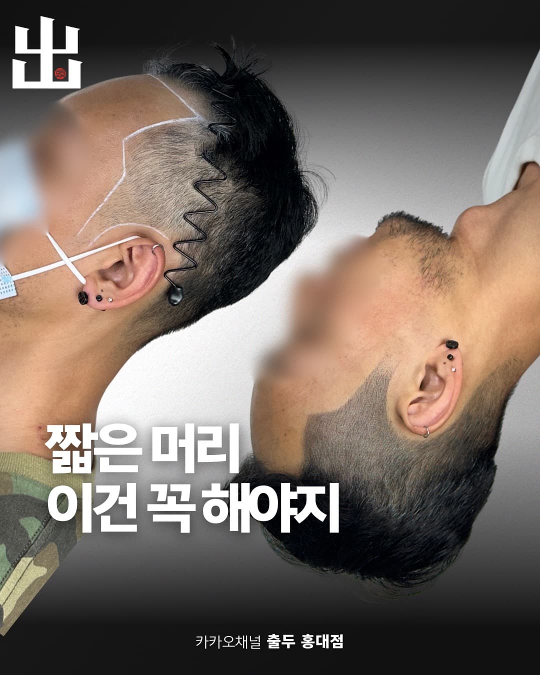 자연스러운 두피문신 시술 전후